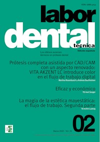 Labor Dental Técnica Nº2 Vol.25 -  - E-Book