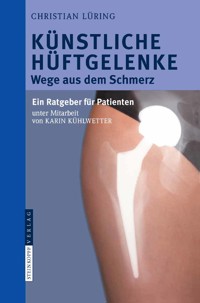 Künstliche Hüftgelenke - C. Lüring - E-Book