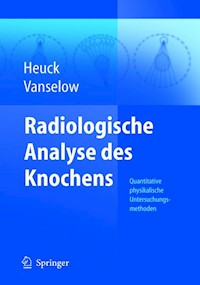 Radiologische Analyse des Knochens - Friedrich Heuck - E-Book
