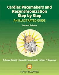 Cardiac Pacemakers and Resynchronization Step by Step - S. Serge Barold - E-Book