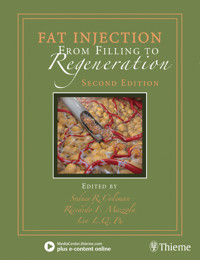 Fat Injection -  - E-Book