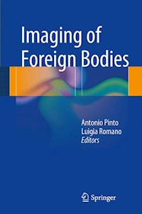 Imaging of Foreign Bodies -  - E-Book