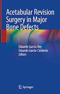 Acetabular Revision Surgery in Major Bone Defects -  - E-Book