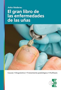 El gran libro de las enfermedades de las uñas - Anke Niederau - E-Book