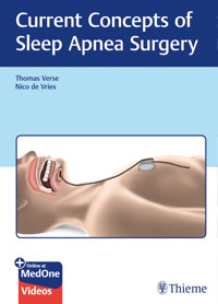 Current Concepts of Sleep Apnea Surgery -  - E-Book