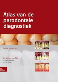 Atlas van de parodontale diagnostiek - Johan van Dijk - E-Book