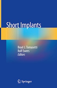 Short Implants -  - E-Book