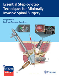 Essential Step-by-Step Techniques for Minimally Invasive Spinal Surgery - Roger Hartl - E-Book