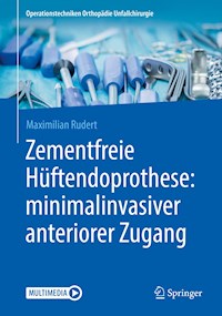 Zementfreie Hüftendoprothese: minimalinvasiver anteriorer Zugang - Maximilian Rudert - E-Book