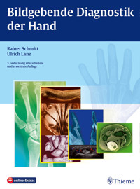 Bildgebende Diagnostik der Hand -  - E-Book