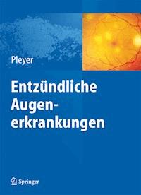 Entzündliche Augenerkrankungen -  - E-Book