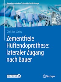 Zementfreie Hüftendoprothese: lateraler Zugang nach Bauer - Christian Lüring - E-Book