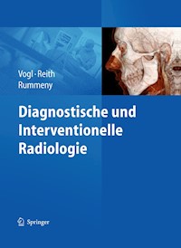 Diagnostische und interventionelle Radiologie -  - E-Book