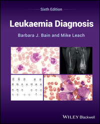Leukaemia Diagnosis - Barbara J. Bain - E-Book
