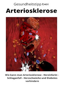 Gesundheitstipp bei Arteriosklerose - Maximilian Loidl - E-Book