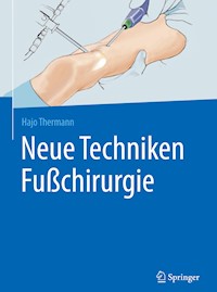 Neue Techniken Fußchirurgie - Hajo Thermann - E-Book