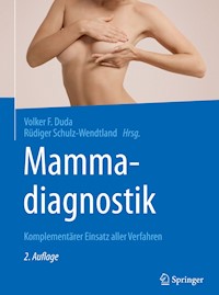Mammadiagnostik -  - E-Book