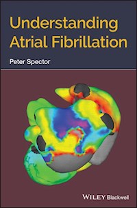 Understanding Atrial Fibrillation - Peter Spector - E-Book