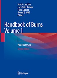 Handbook of Burns Volume 1 -  - E-Book