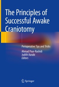 The Principles of Successful Awake Craniotomy -  - E-Book