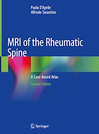 MRI of the Rheumatic Spine - Paola D'Aprile - E-Book