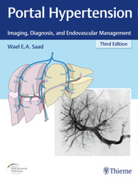 Portal Hypertension - Wael E.A. Saad - E-Book