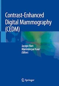 Contrast-Enhanced Digital Mammography (CEDM) -  - E-Book