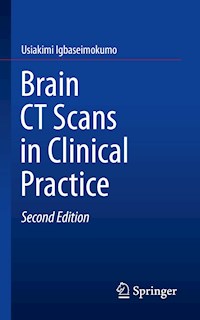Brain CT Scans in Clinical Practice - Usiakimi Igbaseimokumo - E-Book