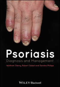 Psoriasis -  - E-Book