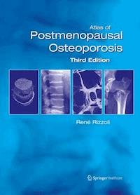 Atlas of Postmenopausal Osteoporosis -  - E-Book