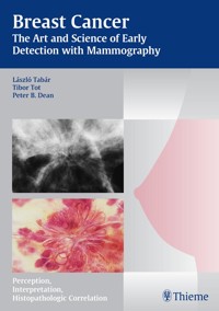 Breast Cancer - The Art and Science of Early Detection with Mammography - Laszlo Tabar - E-Book