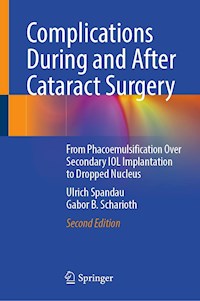 Complications During and After Cataract Surgery - Ulrich Spandau - E-Book