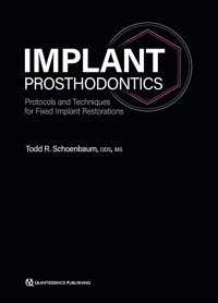 Implant Prosthodontics - Todd R. Schoenbaum - E-Book