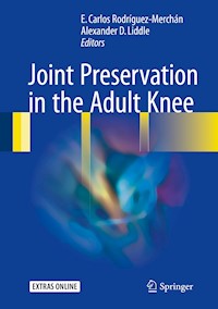 Joint Preservation in the Adult Knee -  - E-Book
