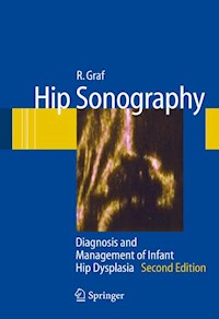 Hip Sonography - R. Graf - E-Book