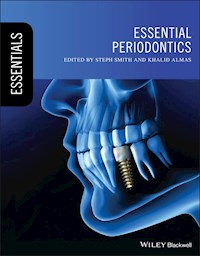 Essential Periodontics -  - E-Book