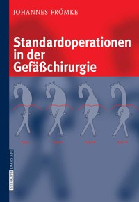 Standardoperationen in der Gefäßchirurgie - Johannes Frömke - E-Book