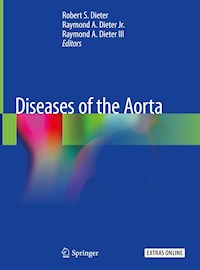 Diseases of the Aorta -  - E-Book