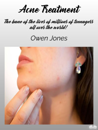 Acne Treatment - Owen Jones - E-Book