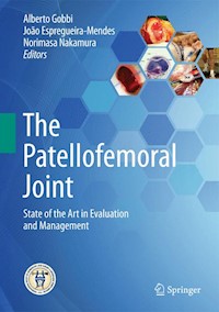 The Patellofemoral Joint -  - E-Book