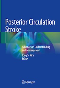 Posterior Circulation Stroke -  - E-Book