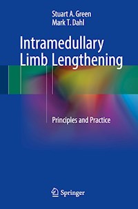 Intramedullary Limb Lengthening - Stuart A. Green - E-Book