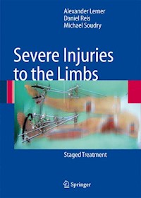 Severe Injuries to the Limbs - Alexander Lerner - E-Book