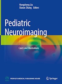 Pediatric Neuroimaging -  - E-Book