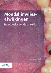 Mondslijmvliesafwijkingen - Isaäc van der Waal - E-Book