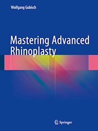 Mastering Advanced Rhinoplasty - Wolfgang Gubisch - E-Book