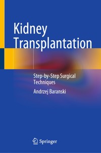 Kidney Transplantation - Andrzej Baranski - E-Book