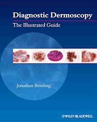 Diagnostic Dermoscopy - Jonathan Bowling - E-Book