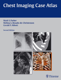 Chest Imaging Case Atlas - Mark S. Parker - E-Book