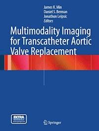 Multimodality Imaging for Transcatheter Aortic Valve Replacement -  - E-Book